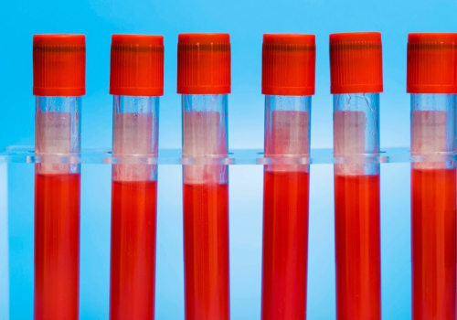What are the Different Types of Genetic Tests? A Comprehensive Guide